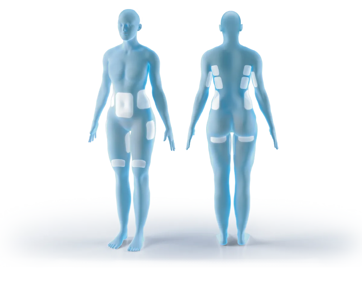CoolSculpting body treatment areas