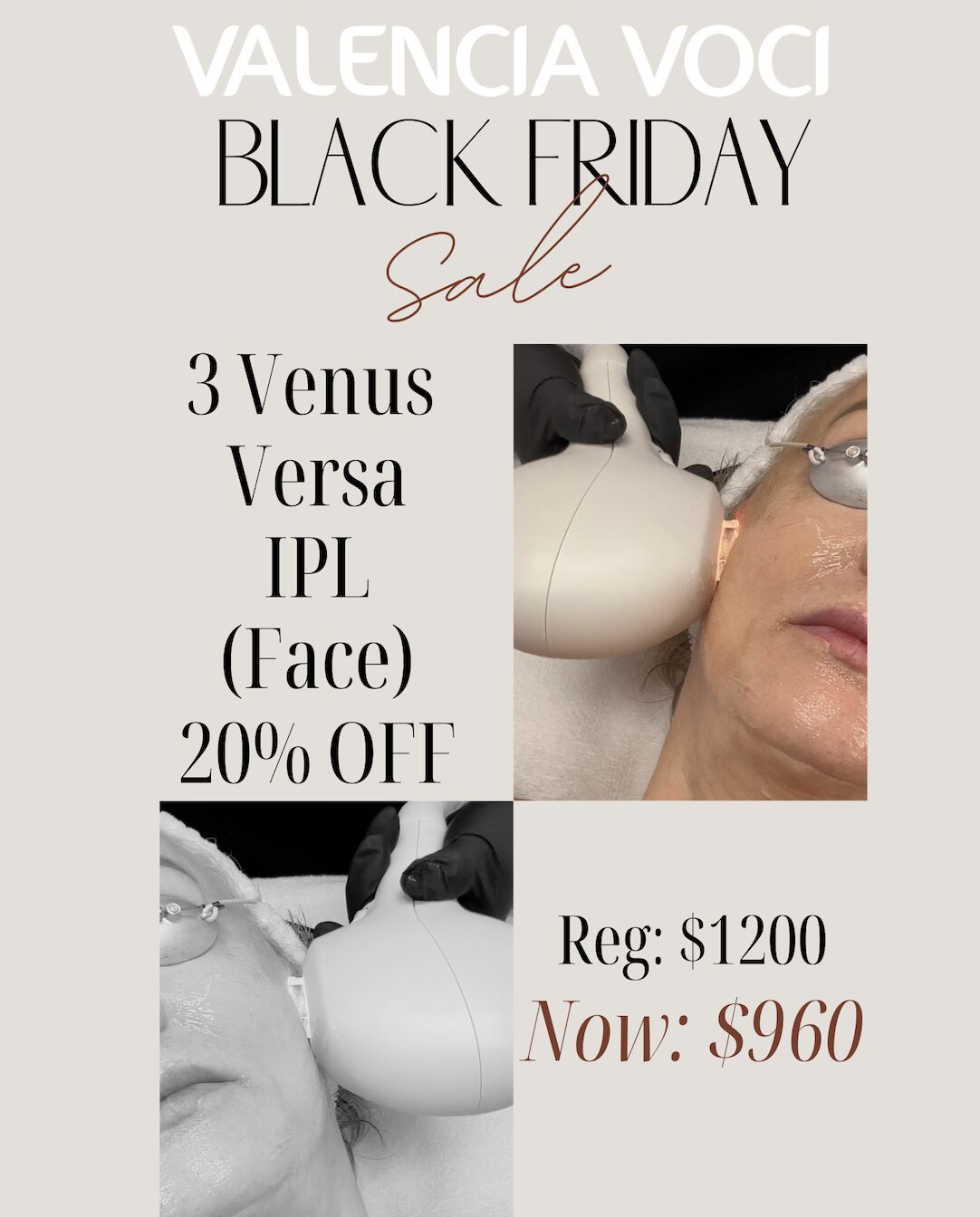 Valencia Voci Black Friday 3 Venus Versa IPL Face 20% off
