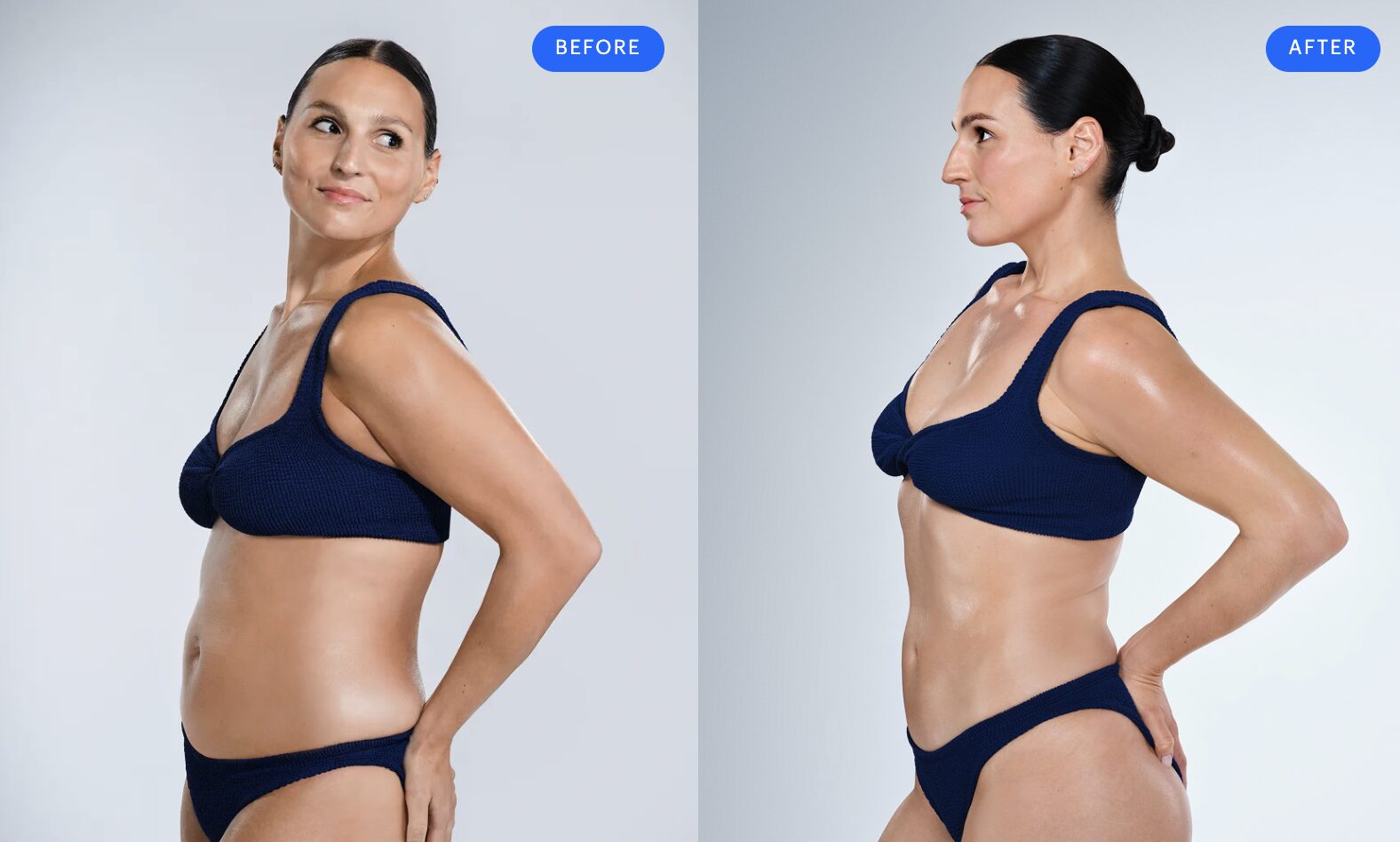 Donna, 29 – CoolSculpting Elite arms, back fat, abdomen, flanks and CoolTone